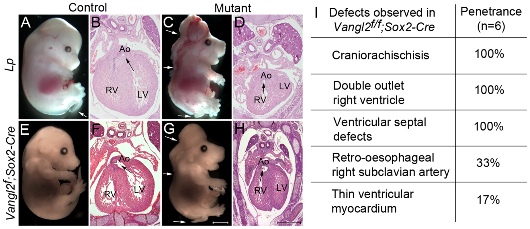 Global loss of Vangl2 recapitulates the <i>Lp/Lp</i> phenotype.
