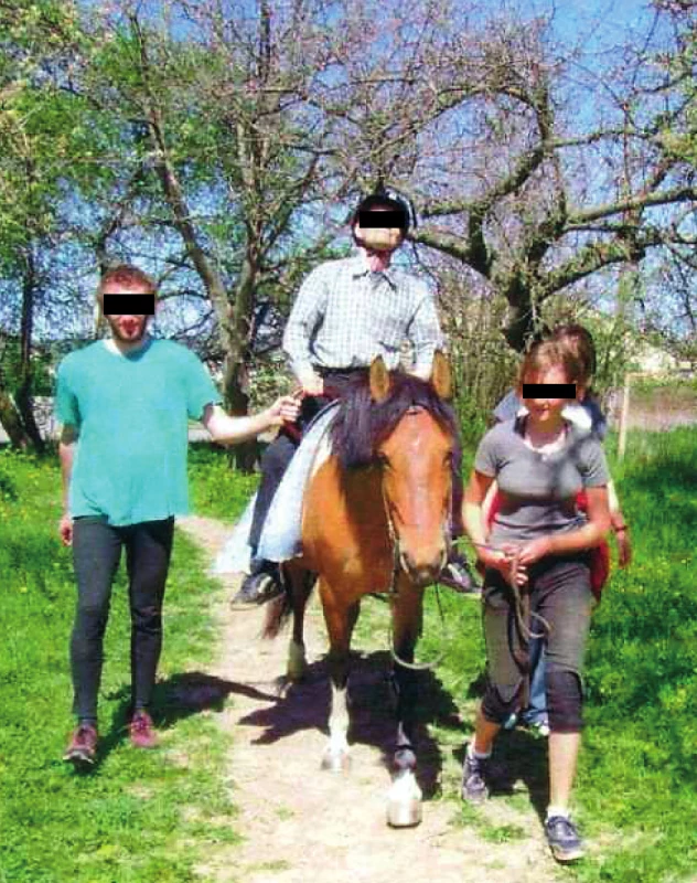 Roztroušená mozkomíšní skleróza. Klinicky dominuje středně těžká centrální kdvadruparéza. Labužnické užívání si léčebné procedury.