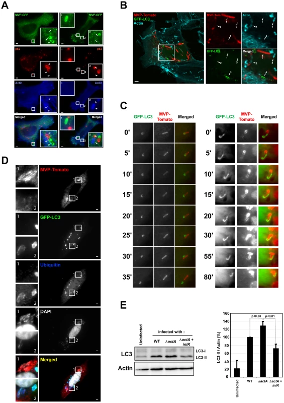 MVP impairs the recruitment of autophagy markers.