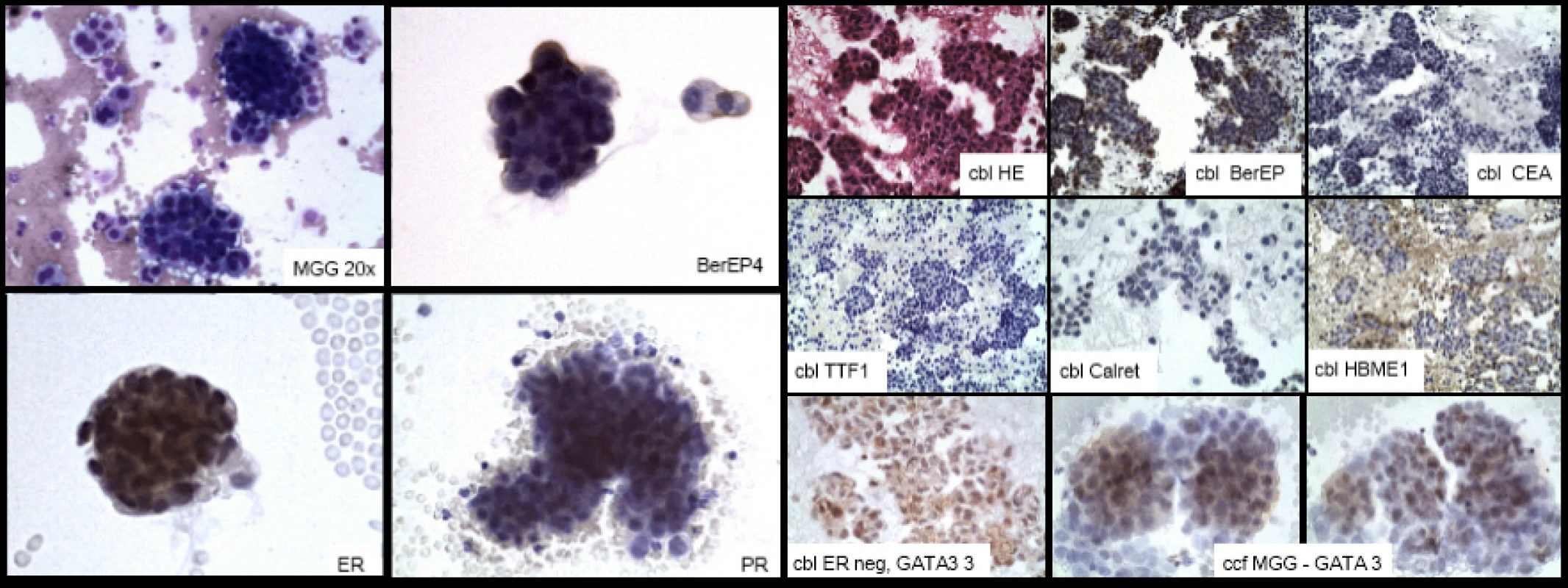 Příklad současného rozsahu cytologického vyšetření.