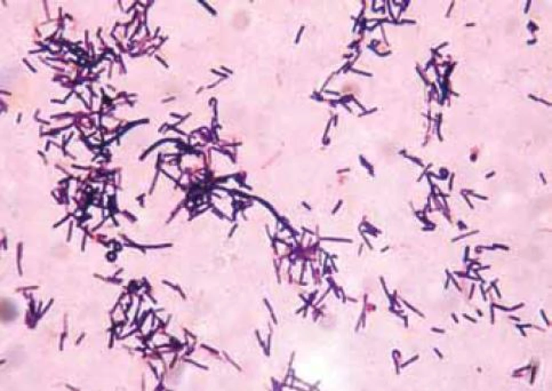 Kmen 29B Lactobacillus acidophilus.