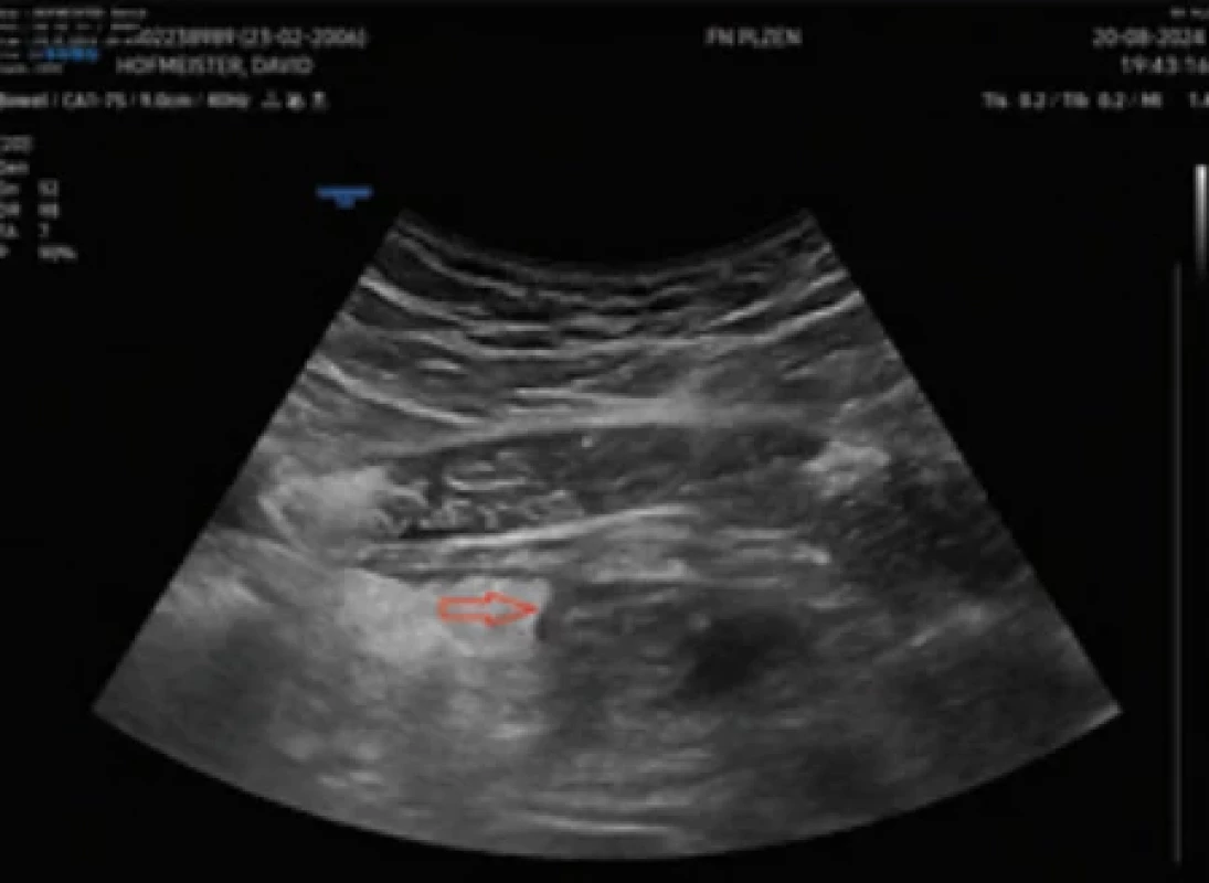  / Fig. 2.