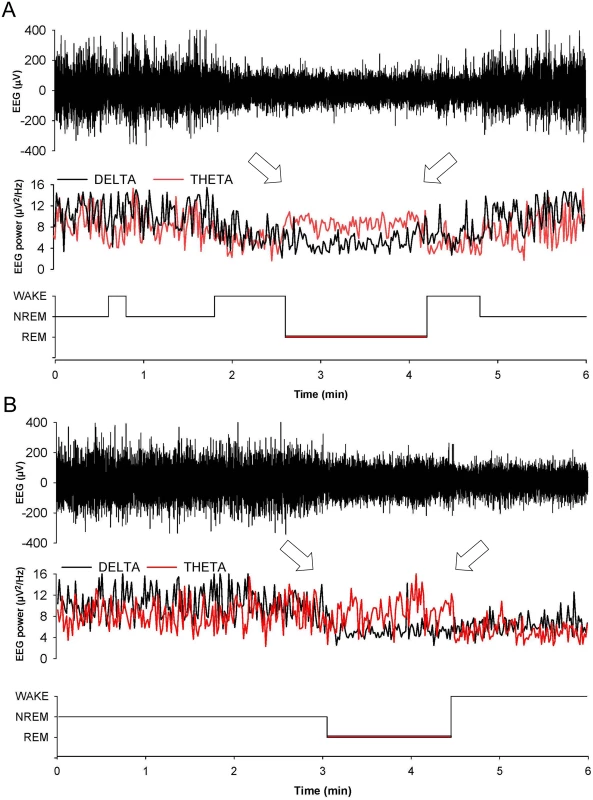 Entry in REM sleep is abnormal in Tg(FFI) mice.