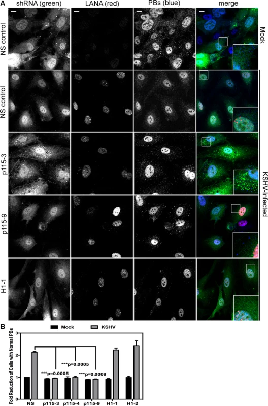 Knockdown of the Rho guanine exchange factor (GEF) p115 prevents KSHV-induced disruption of p-bodies in latently infected endothelial cells.