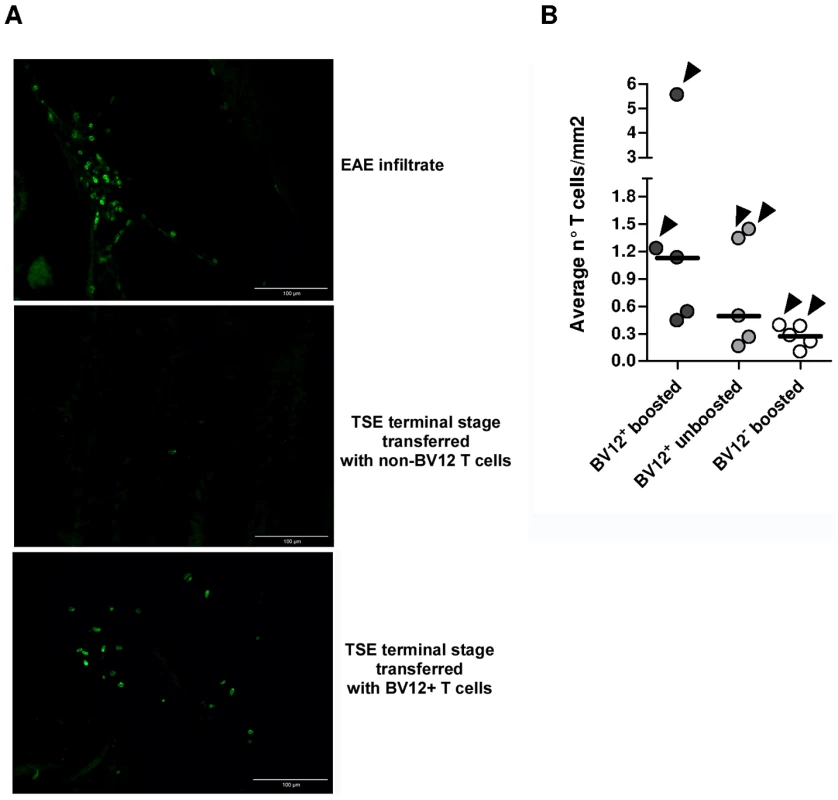 Presence of infiltrating T cells in the brain of adoptively transferred mice.