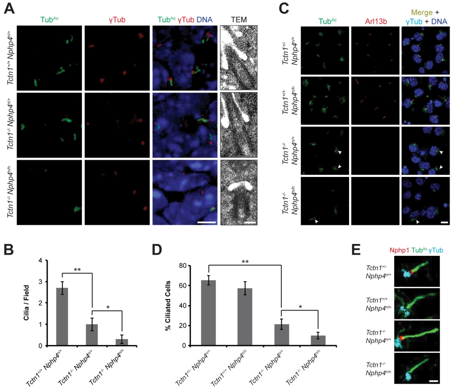 Mouse Tctn1 and Nphp4 have distinct roles in transition zone composition and overlapping roles in ciliogenesis.