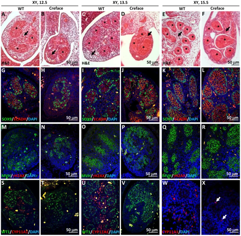 Testicular dysgenesis in mouse embryo lacking <i>Hhat</i>.