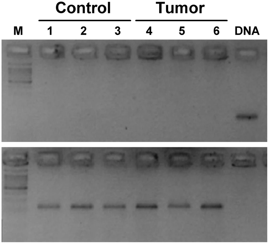 Absence of <i>Lasc1</i> gene expression in mouse normal lung and lung tumors of (A/J×C57BL/6J)F1 mice.
