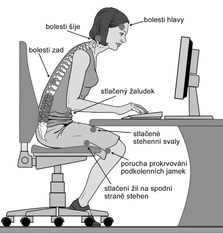Nesprávné sezení u počítače