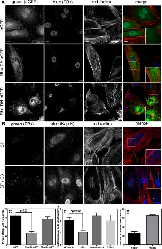 KapB activation of RhoA-GTPase but not the downstream kinase ROCK is necessary for p-body disruption.