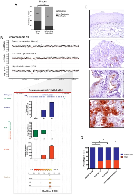 <i>DMBT1</i> upregulation by non-CpG island methylation changes.