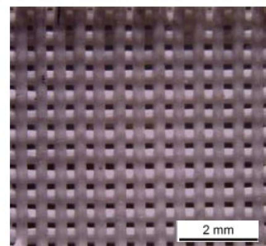 Zirconia scaffolds designed with the smallest pore sizes (35×).
