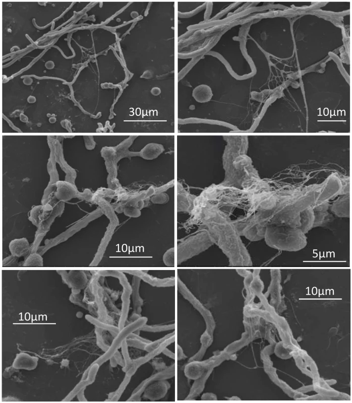 Scanning electron microscopy of pDCs incubated with <i>A</i>. <i>fumigatus</i> hyphae.