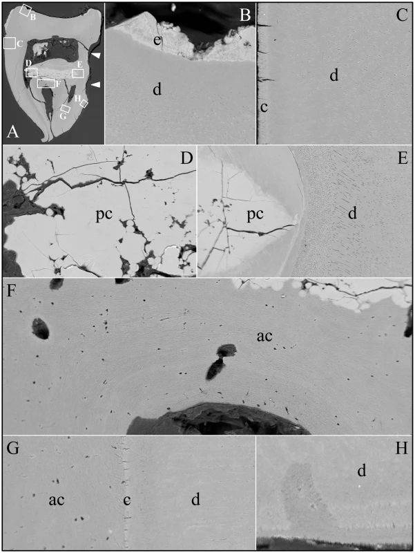 Backscatter Scanning Electron Micrographs (bSEMs) of molar (#32).