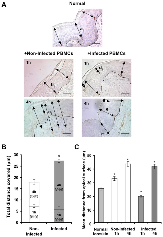 HIV-1-infected cells modify the spatial distribution of LCs in inner foreskin.