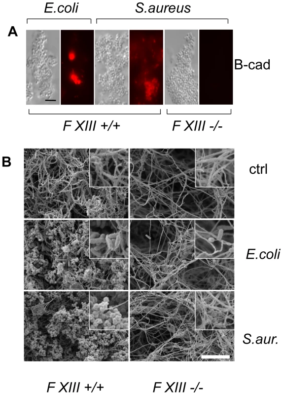 Human F XIII sequesters bacteria in the clot matrix.
