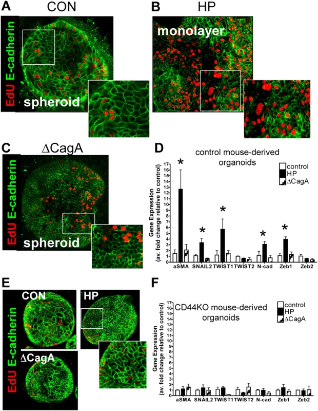 <i>H. pylori</i>-induced epithelial-to-mesenchymal transition (EMT).
