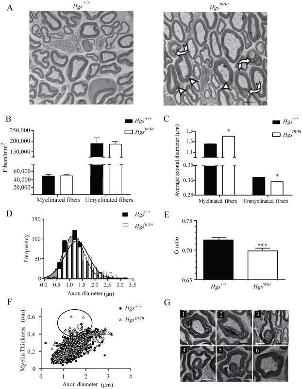 Examination of sciatic nerves from 4-week-old <i>Hgs</i><sup><i>+/+</i></sup> and <i>Hgs</i><sup><i>tn/tn</i></sup> mice.