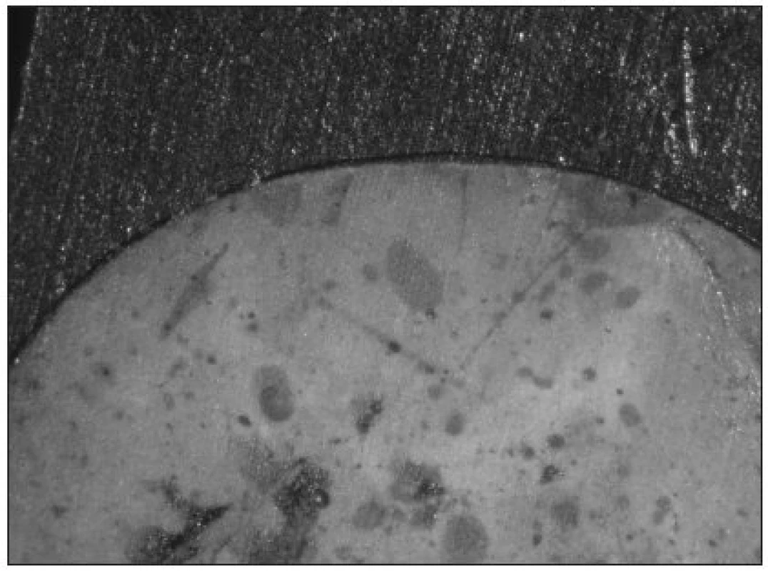 Spára na sklovinném okraji výplně vznikající při použití self-etching adheziva iBond a expozici v destilované vodě po dobu 24 hodin.