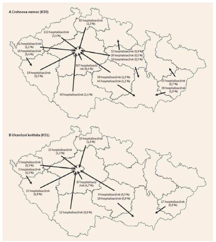 Migrace za hospitalizací mimo kraj bydliště. A. Migrace za hospitalizací s Crohnovou nemocí (K50), B. migrace za hospitalizací s ulcerózní kolitidou (K51). Uveden je průměrný roční počet hospitalizací pacientů s bydlištěm v daném kraji migrujících mimo kraj svého bydliště (znázorněno šipkou) a jejich podíl na celkovém počtu hospitalizací pro K50 a K51. Zobrazeny jsou pouze migrace do krajů, které představují hlavní směry migrace z daného kraje.
Fig. 1. Migration for inpatient treatment outside the region of residence; A. Crohn’s disease (K50), B. ulcerative colitis (K51). The arrows show the average number per year of hospitalizations of patients with residence in the given region migrating outside their region of residence and their share in the total number of hospitalizations for K50 or K51, resp. Only the main migration paths are shown.