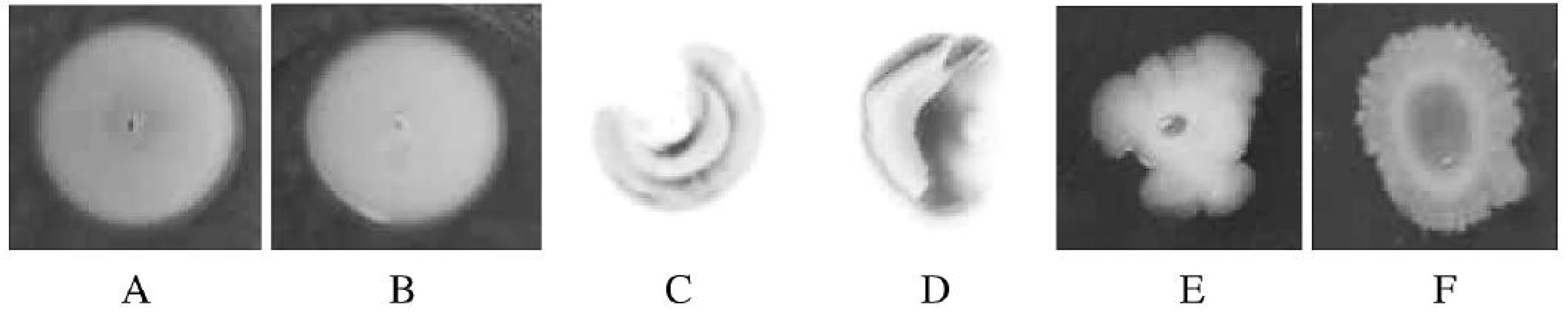Test na swimming (A, B), twitching (C, D) a swarming (E, F) motilitu

Fig. 2. Swimming (A, B), twitching (C, D), and swarming (E, F) motility assays