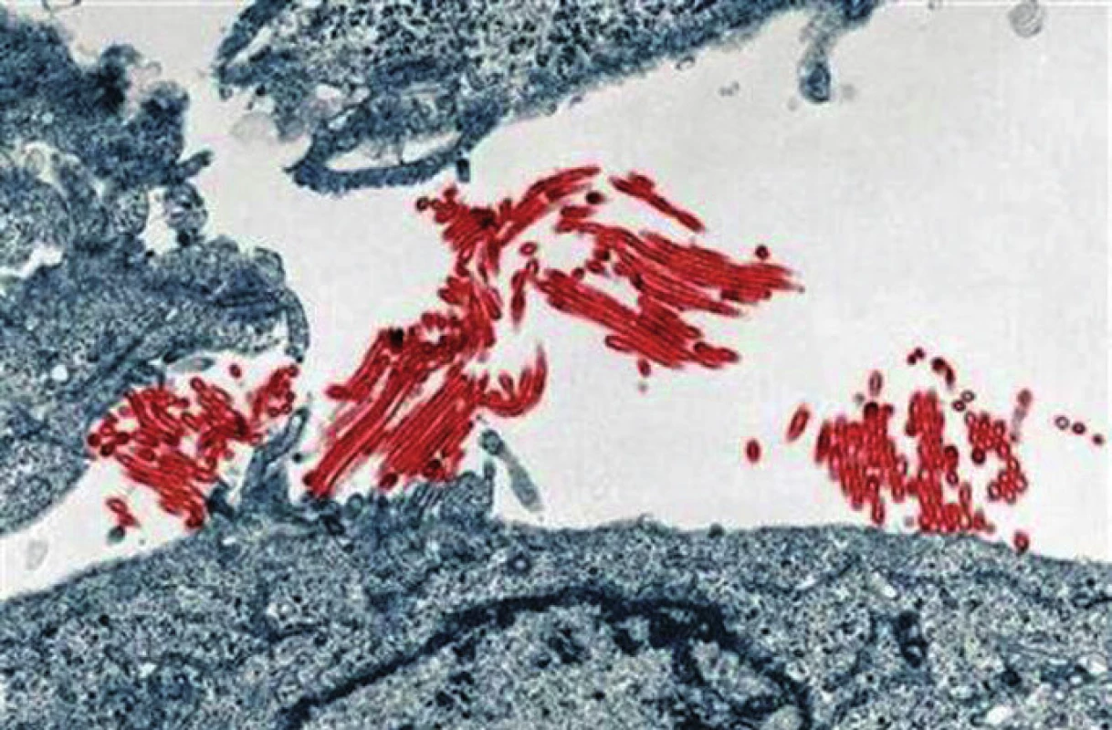 Virus A(H1N1) - červeně