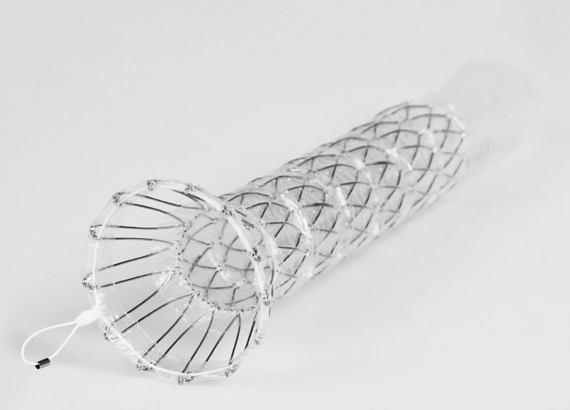 Boubella E – Různé typy expandibilních metalických stentů ELLA
Fig. 1. Boubella E – various types of ELLA expandable metallic stents