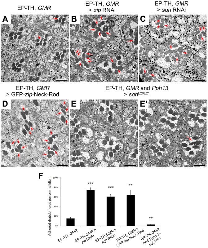 Non-muscle myosin II is involved in retinal lumen formation.