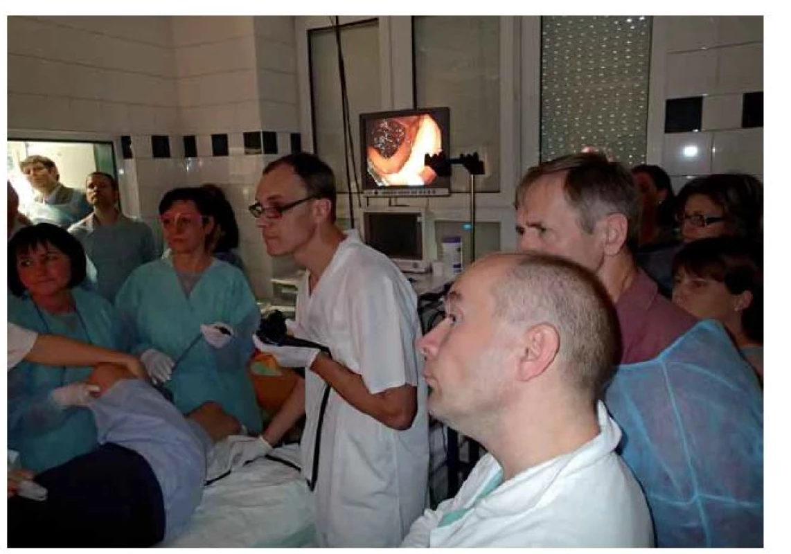 Ondřej Urban s týmem Beskydského gastrocentra provádí endoskopickou slizniční resekci reziduální neoplazie tračníku.
Fig. 1. Ondřej Urban together with team from Beskydy gastrocentrum performs endoscopic mucosal resection of residual neoplasia in colon.