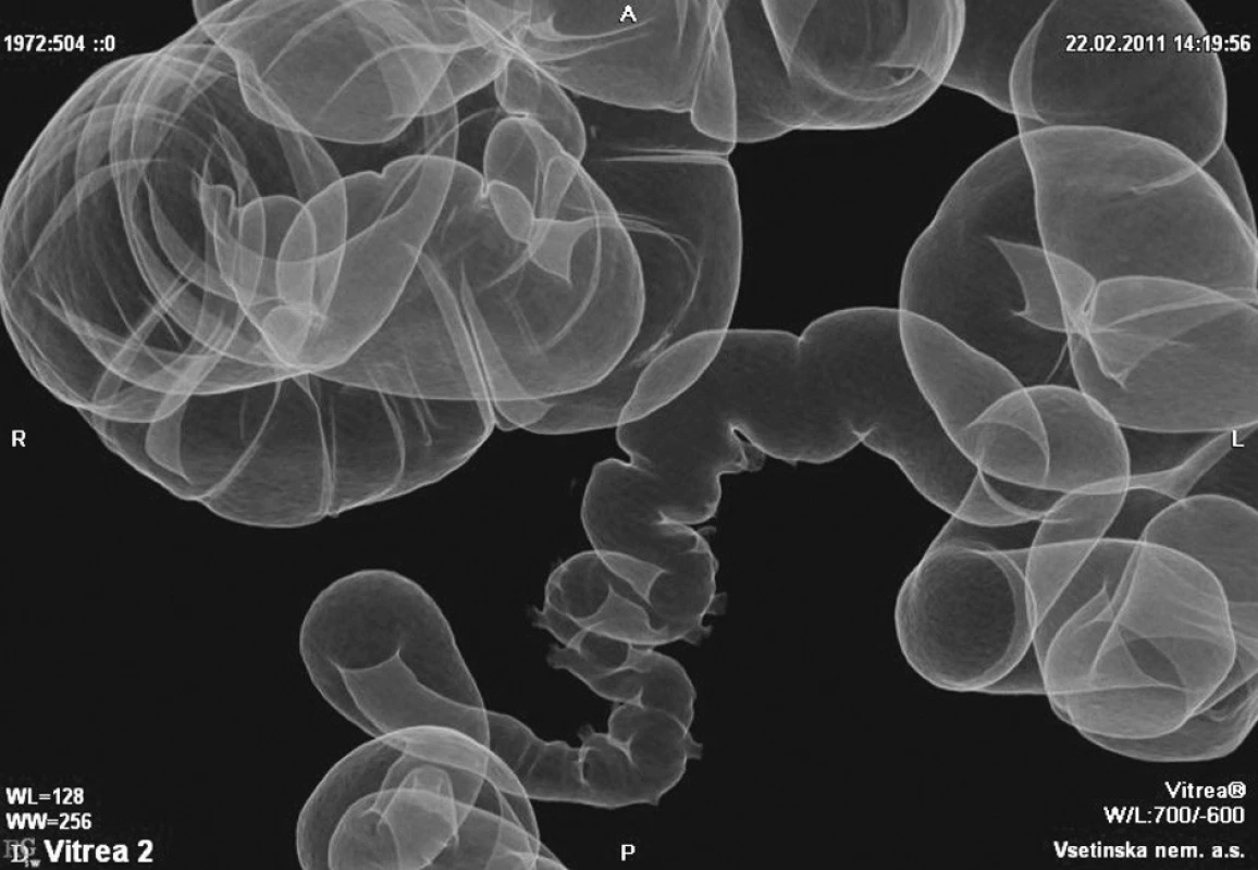 Virtuální irigografie
Fig. 3. Virtual irigography