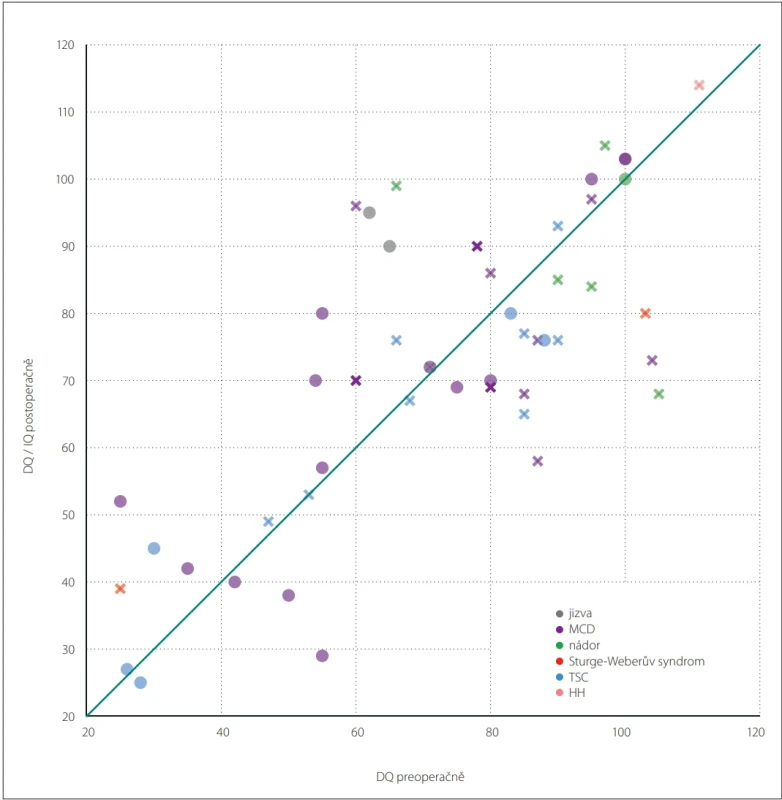 Porovnání DQ před a DQ či IQ po operaci a závislost na typu patologie DQ – vývojový kvocient; HH – hypotalamický hamartom; IQ – inteligenční kvocient; MCD – malformace kortikálního vývoje; TSC – tuberózní skleróza Fig. 2. Comparison of preoperative DQ with postoperative DQ or IQ, stratifi ed by pathology type. DQ – developmental quotient; HH – hypothalamic hamartoma; IQ – intelligence quotient; MCD – malformations of cortical development; TSC – tuberous sclerosis complex