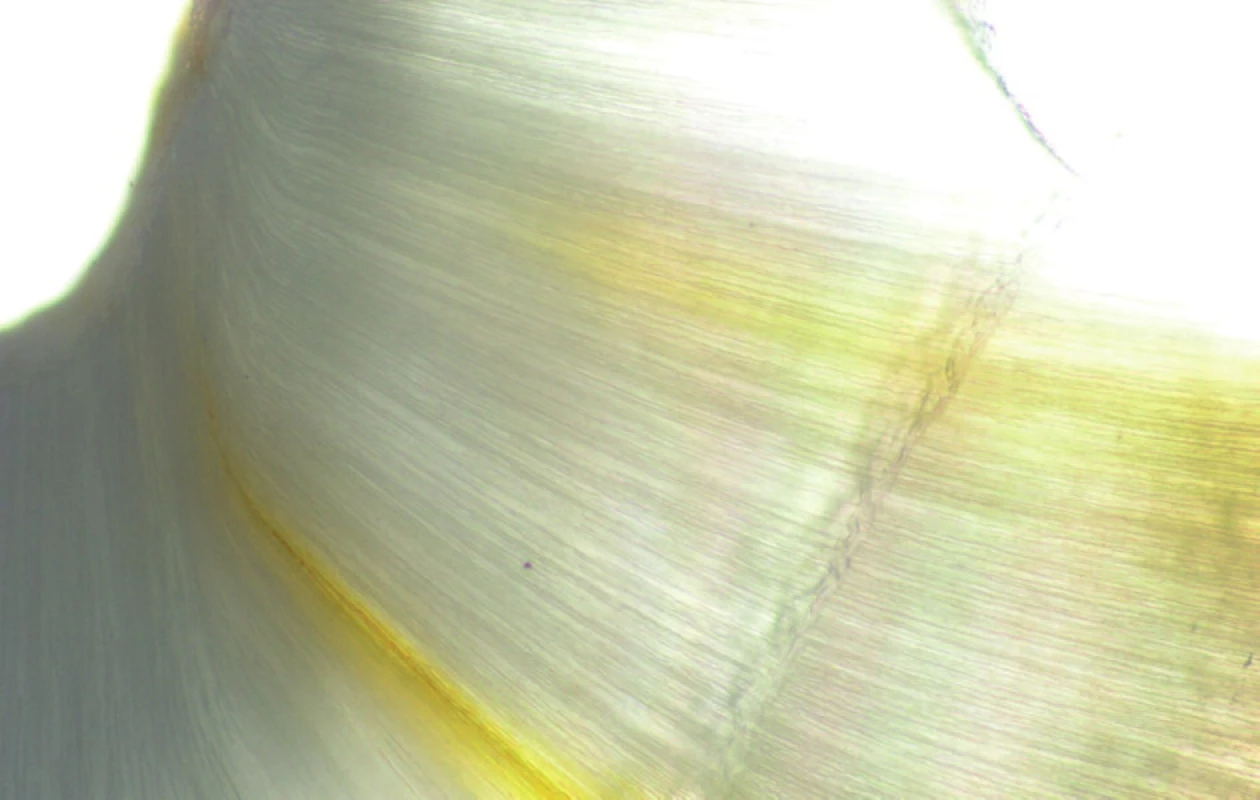Skupina C - mikroskopický detail.