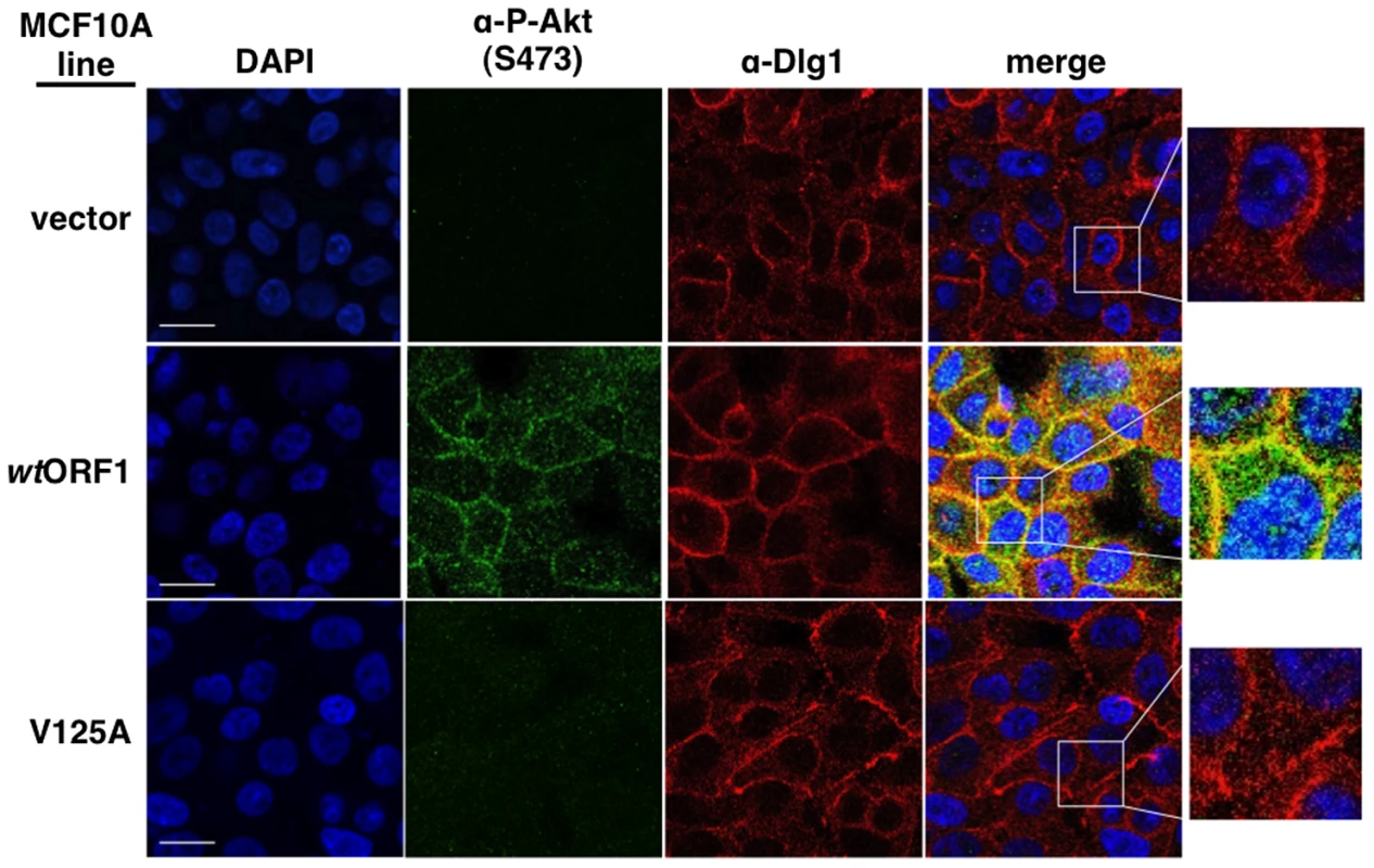 Sites of E4-ORF1-induced activation of PI3K effector Akt co-localize with Dlg1 at the plasma membrane.