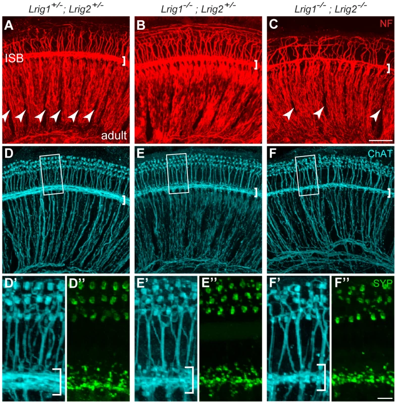 Cochlear structure and patterning is normal in <i>Lrig1<sup>−/−</sup></i>;<i>Lrig2<sup>−/−</sup></i> double mutants but cochlear innervation is disrupted.