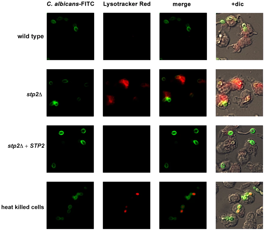 <i>C. albicans</i> alkalinizes the macrophage phagosome.