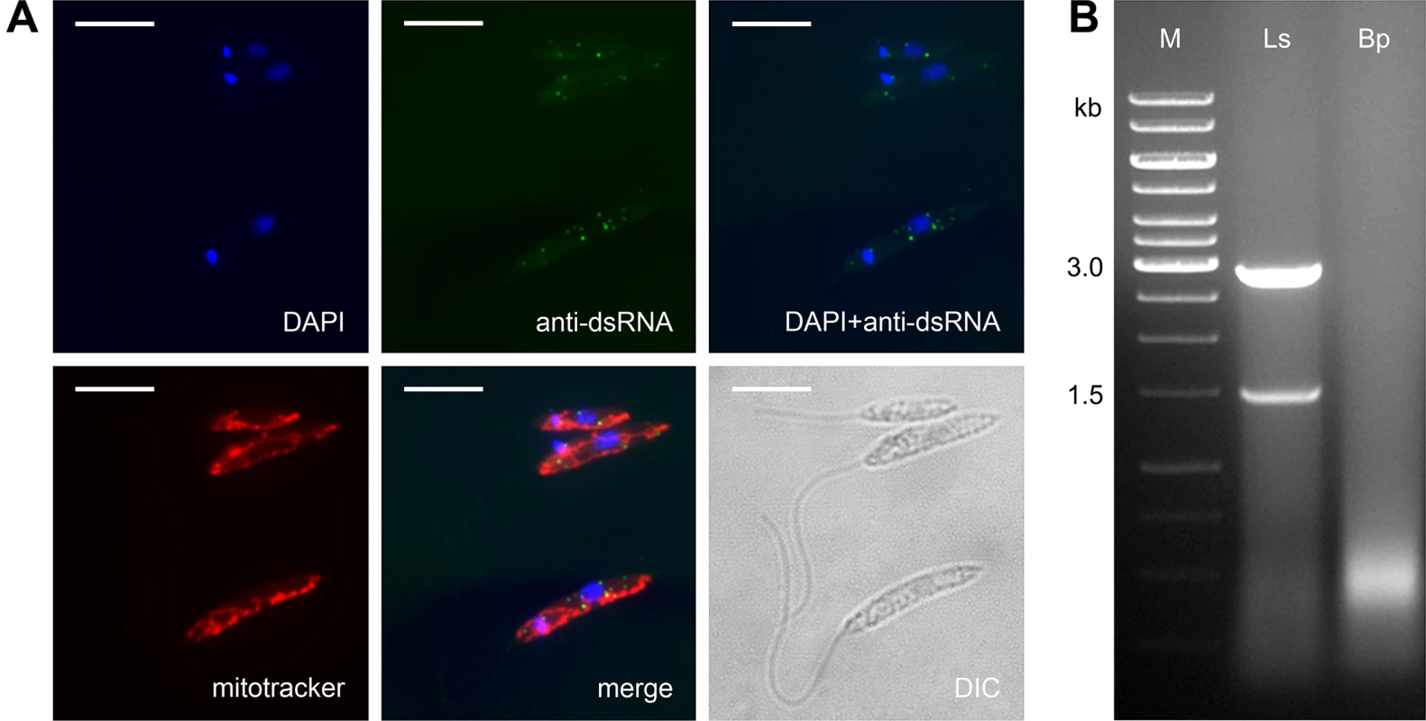 <i>Leptomonas seymouri</i> harbors dsRNA viruses.