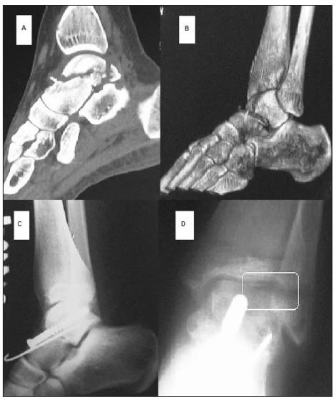 <br>Fig. 3.