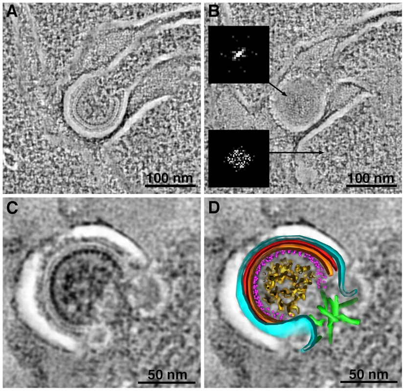 Structural details in negatively-stained images of HIV-1 in infected GALT.