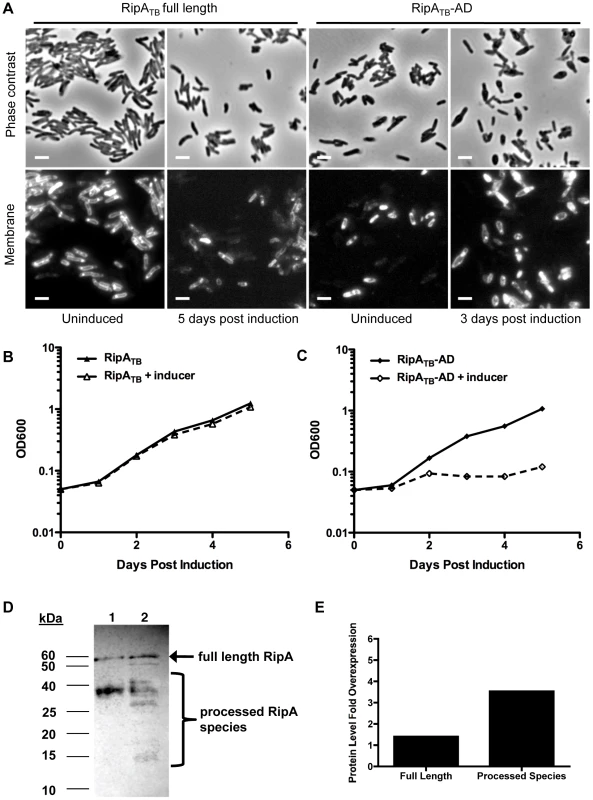 Processed RipA is toxic to <i>M. tuberculosis</i>.