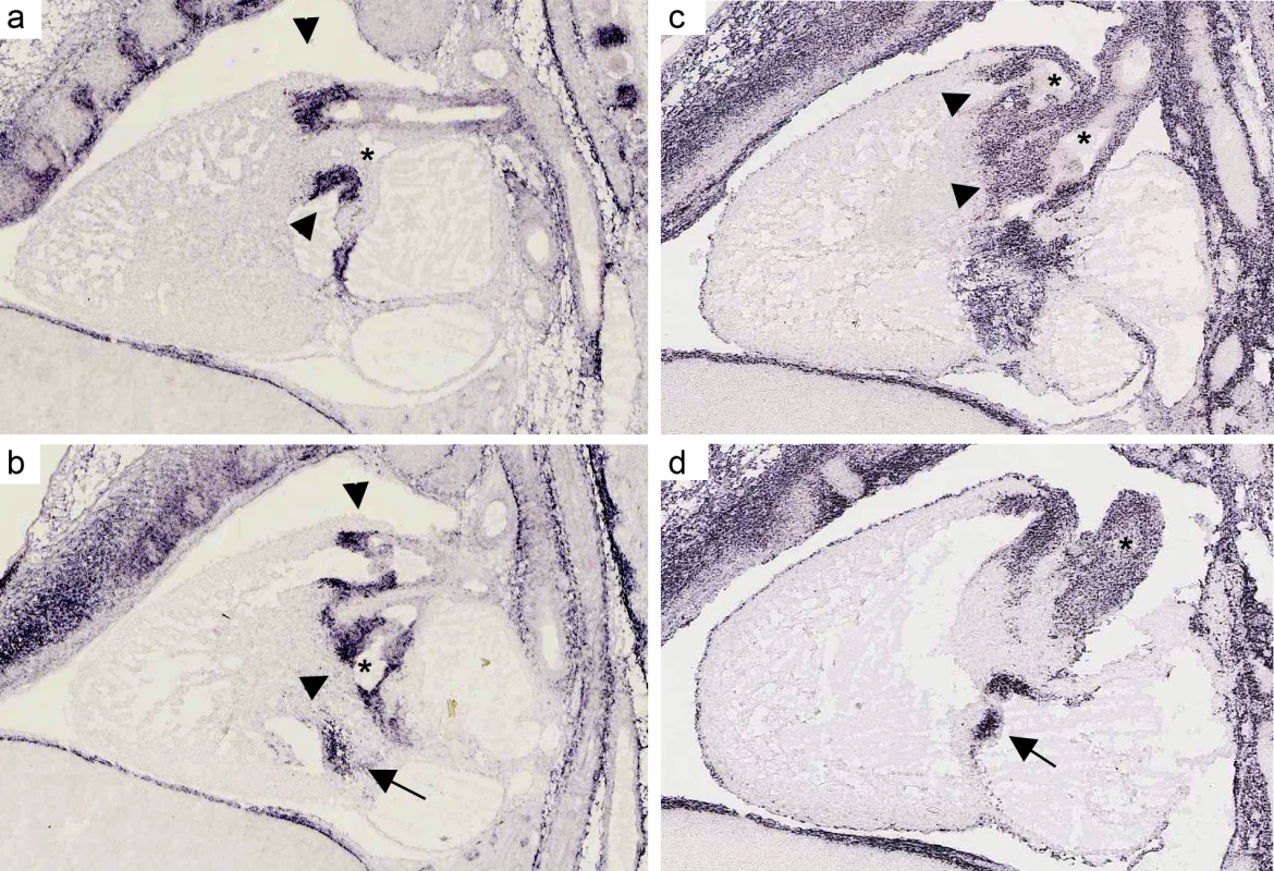 mRNA expression profile of <i>CTHRC1</i> and <i>MFAP4</i> in embryonic mouse heart.