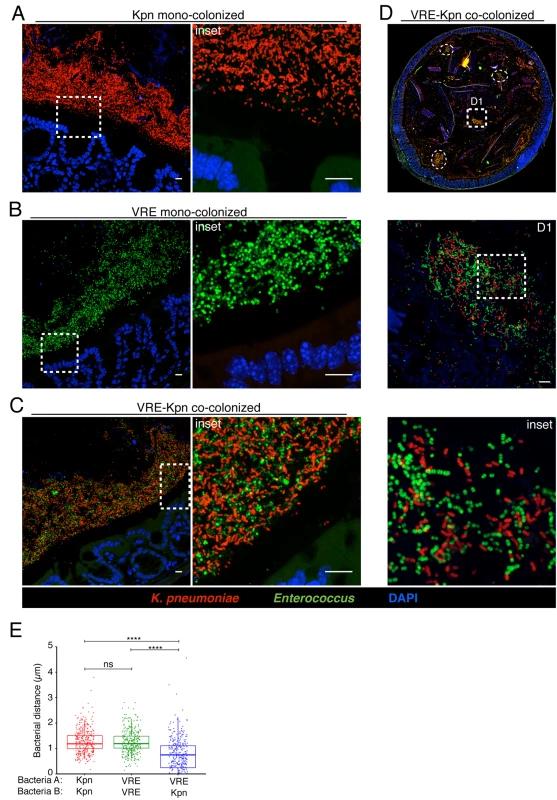 <i>K</i>. <i>pneumoniae</i> and VRE reside within the same intestinal regions but occupy distinct metabolic niches.