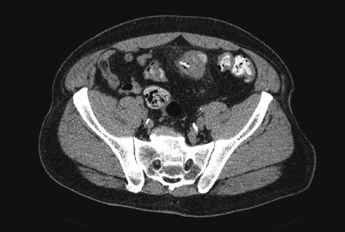 <br> Fig. 2.
