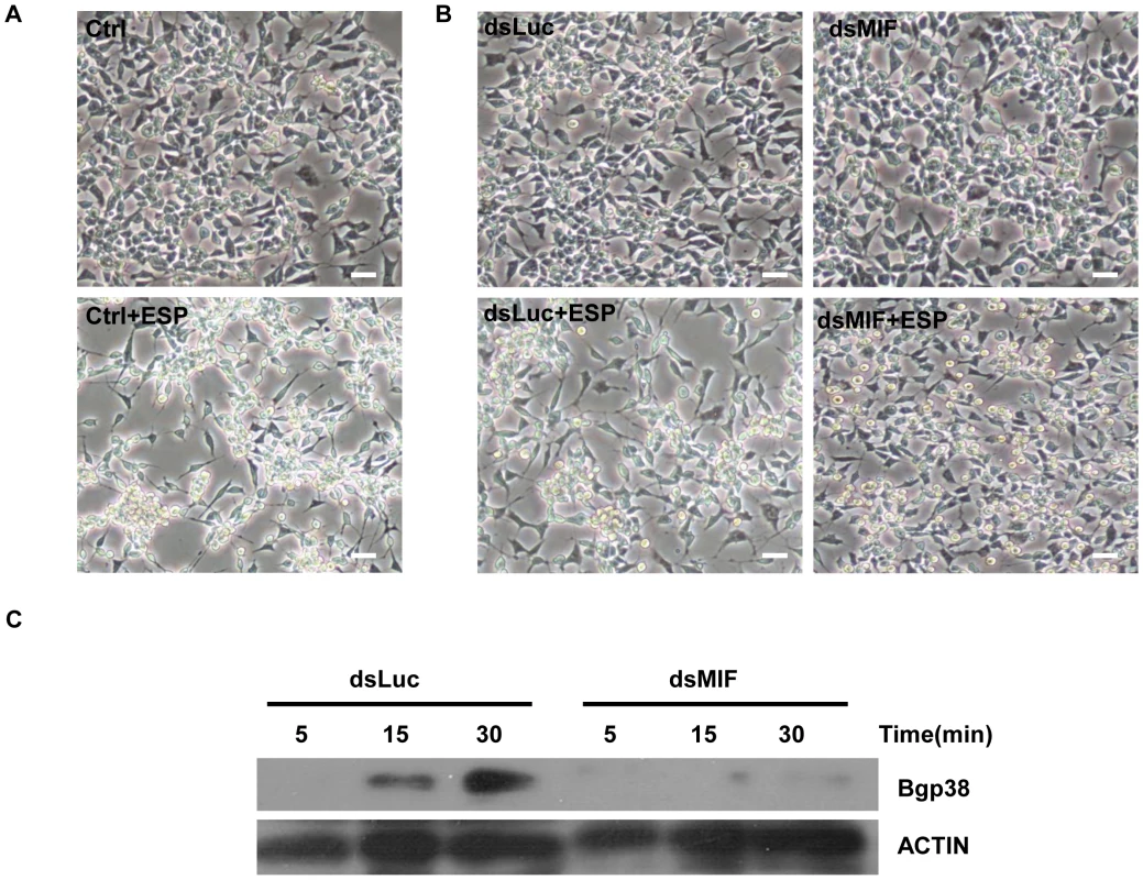 BgMIF promotes an aggregative phenotype and Bgp38 activation induced by ESP.