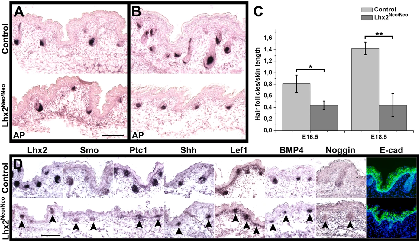 Reduced expression of Lhx2 hampers HF morphogenesis.