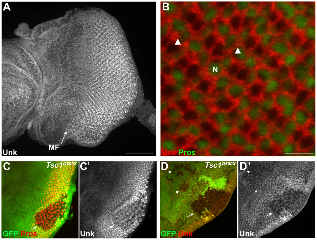 Unk expression is regulated by <i>Tsc1</i> in differentiating photoreceptors.
