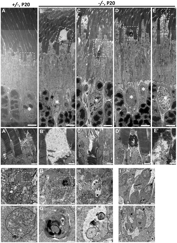 Ultrastructural changes of cone and rod photoreceptors upon ablation of <i>Ranbp2</i> in cones at P20.