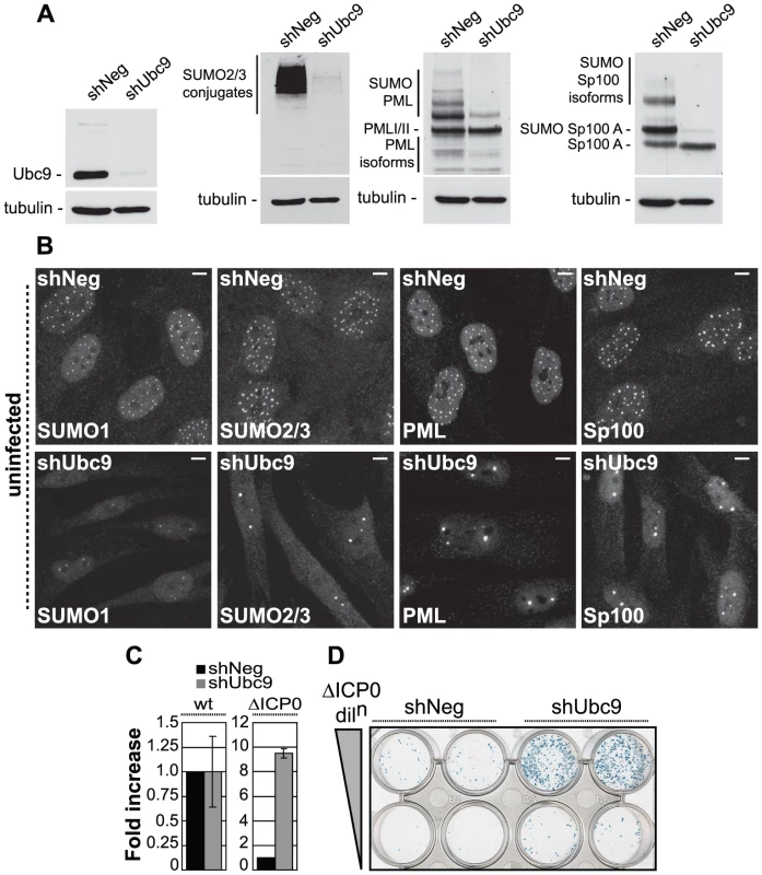 The SUMO pathway contributes to intrinsic antiviral resistance to HSV-1 infection.