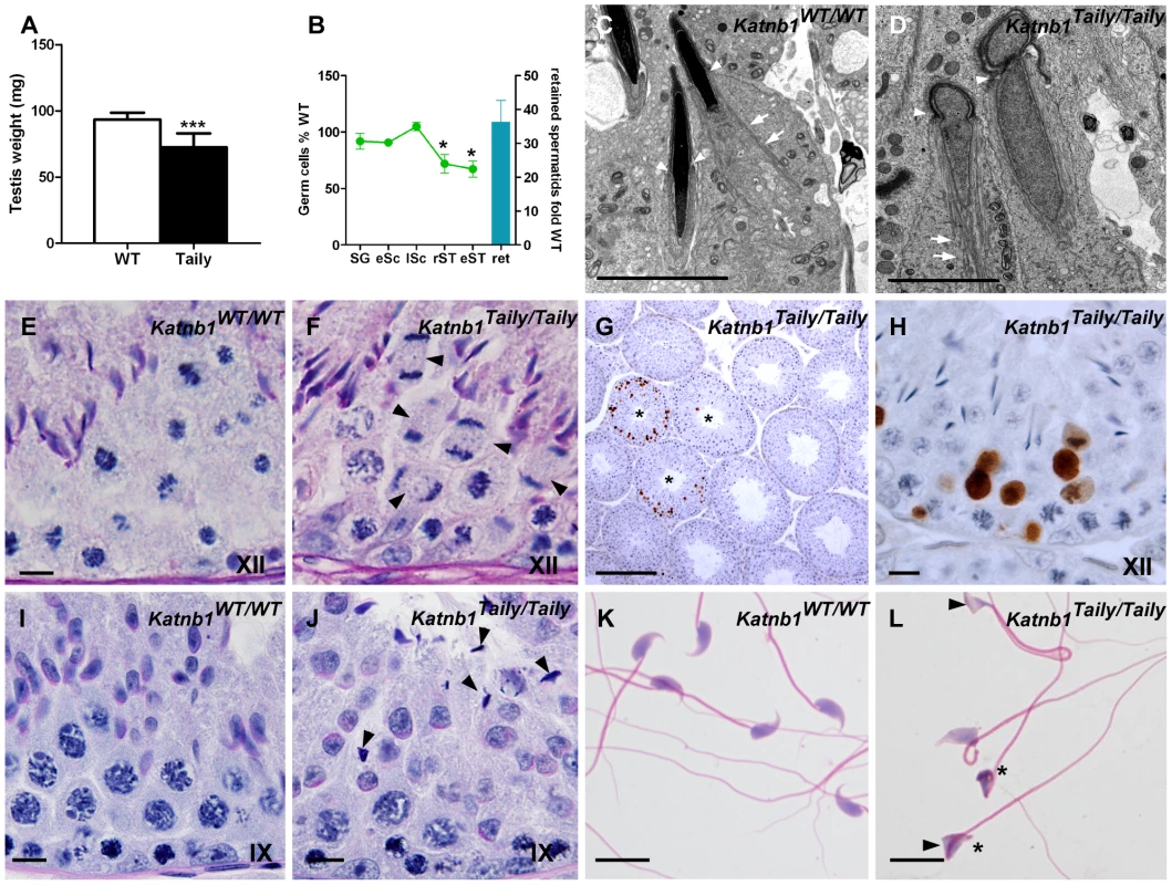 Spermatogenic defects in Taily mice.