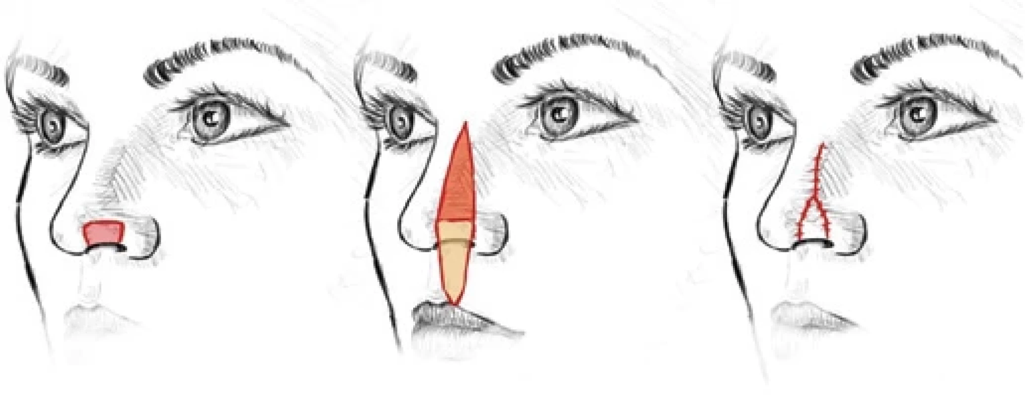 Hinged turnover fl ap. (Drawing by A. Berkeš).