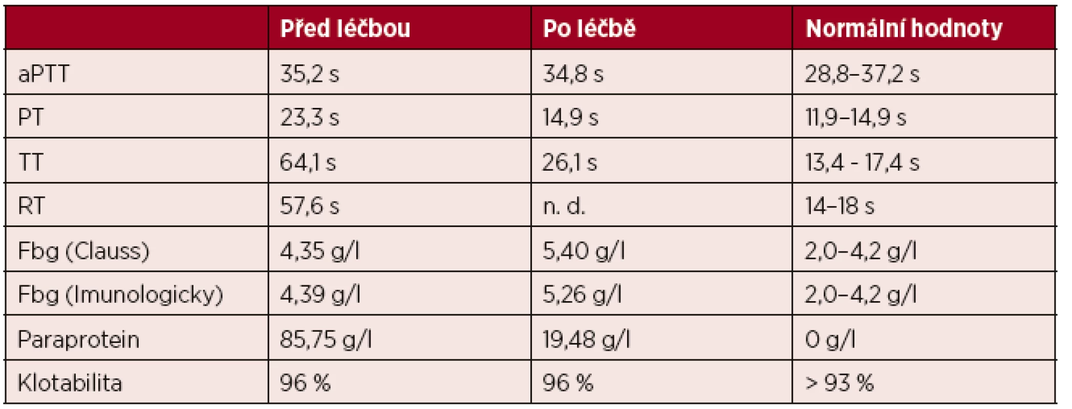 Výsledky koagulačního vyšetření u získané dysfibrinogenemie
